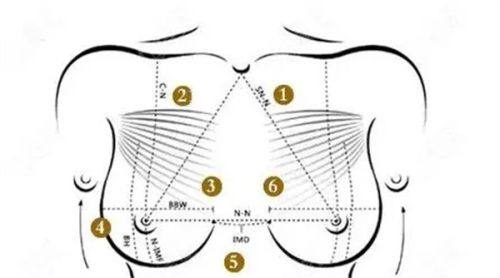 三、50岁人群割双眼皮修复期为何更长