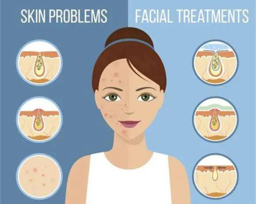 四、不同年龄层的去眼袋手术优选方案