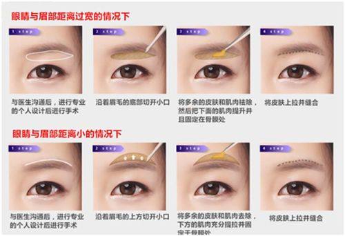 五、现代科学视角下的疤痕与命运