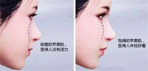 四、头发种植靠谱吗，成效保护来自哪里