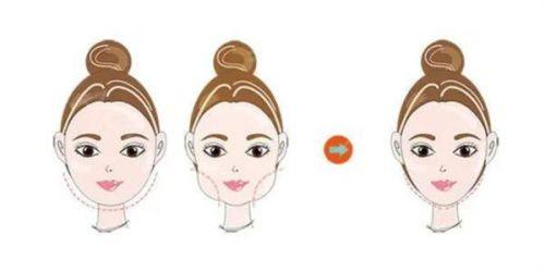 四、抽脂术后针眼疤痕色素:短期或可自然淡化,长期不消需专精治疗