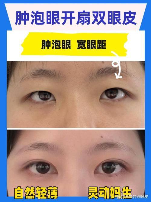 福州市医院整形美容科预约挂号方式: