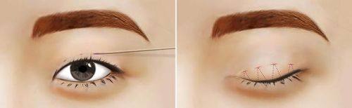 福州市医院整形美容科地址电话及营业时间: