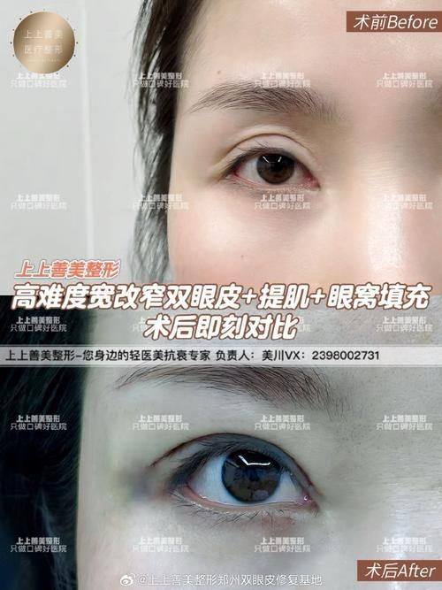 福州市医院整形美容科擅长项目: