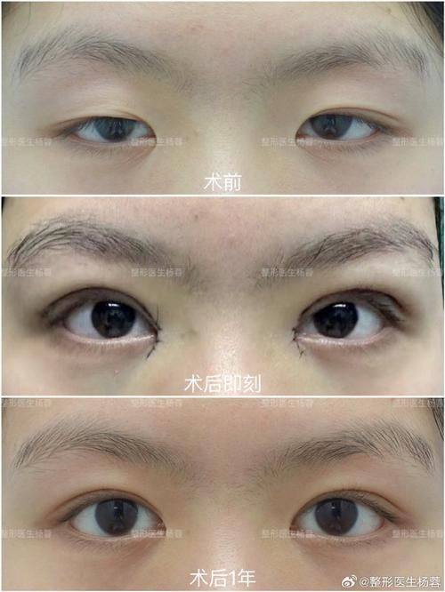 北京华韩医疗美容整形医院怎么样?