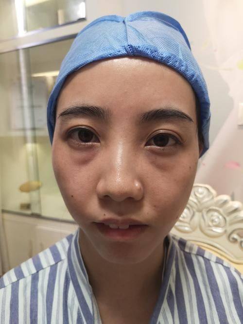 珠海爱思特医疗美容医院预约挂号方式: