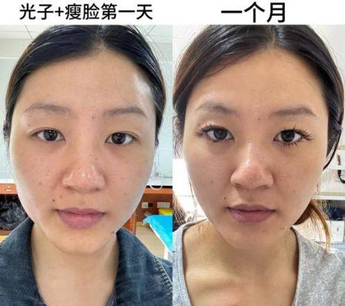 沈阳刘延海整形医疗美容诊所价格表