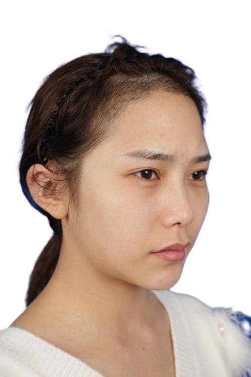 北京华韩医疗美容整形医院价格表