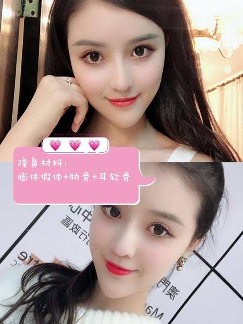 菏泽丽雅医疗美容诊所价格表：