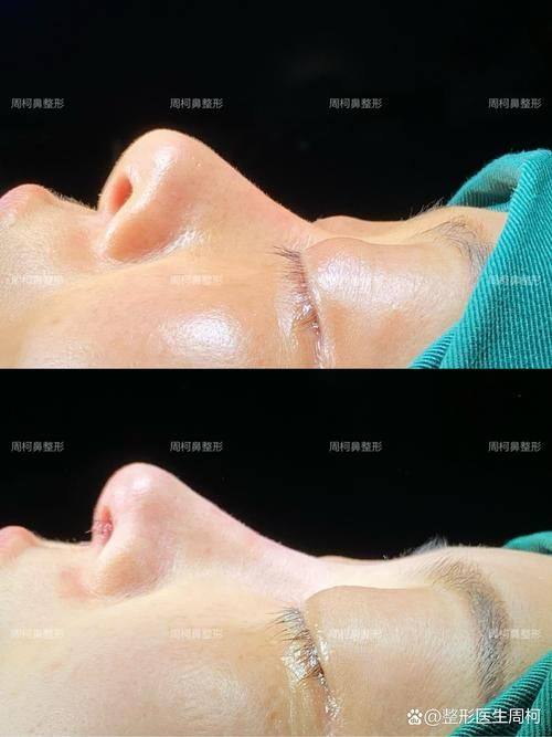 沈阳刘延海整形医疗美容诊所预约挂号方式