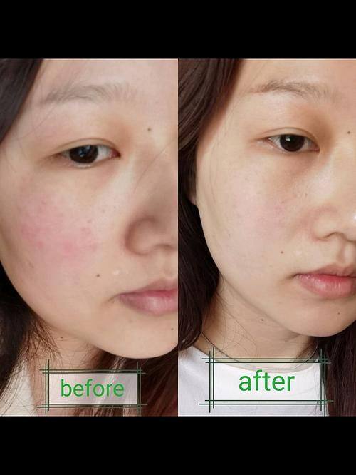 北京华韩医疗美容整形医院擅长项目: