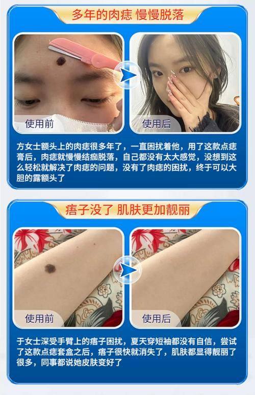 Elev医院预约挂号方式