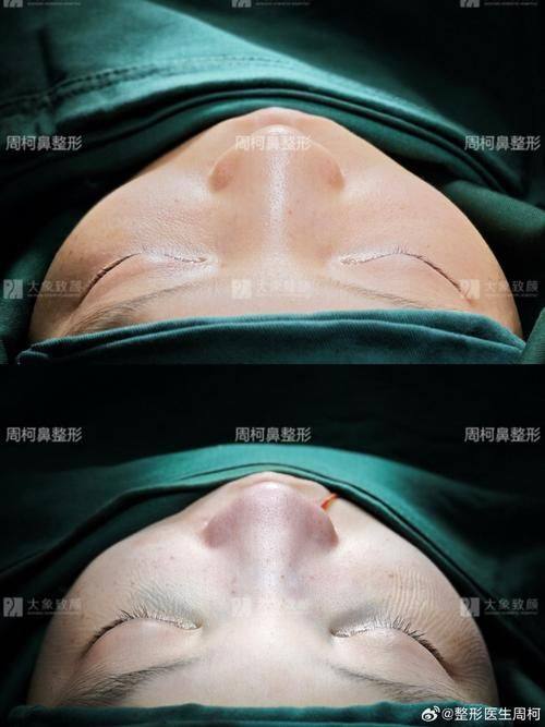 福建医 科 大学附属协和医院整形激光美容中 心医生名单及擅长领域：