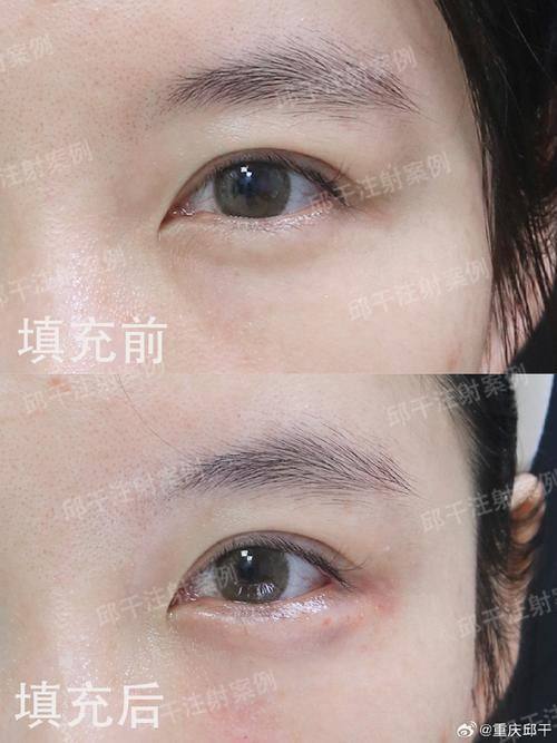 菏泽丽雅医疗美容诊所口碑评价：