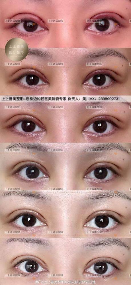 江西省儿童医院(整形美容科)口碑评价：