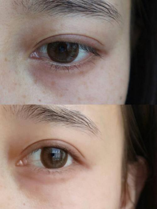 福建医 科 大学附属协和医院整形激光美容中 心口碑评价