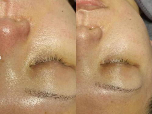 江西省儿童医院(整形美容科)价格表：