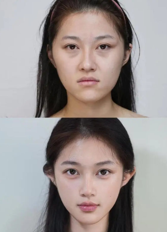 三、眼部健康问题：术前必须先解决病灶