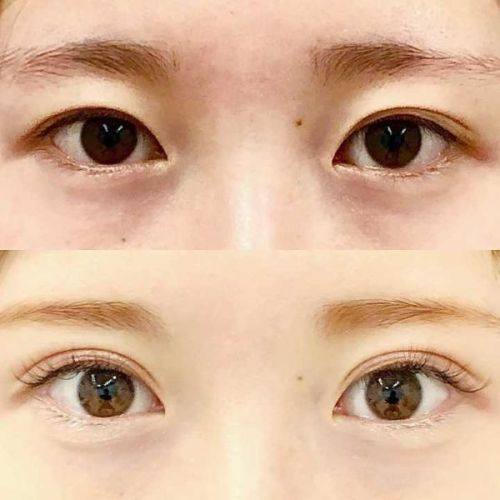 邯郸纺织有限公司职工医院美容整形科口碑评价