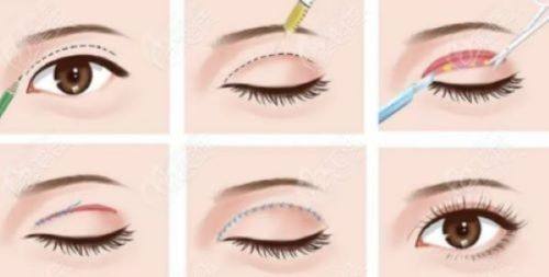 肇庆民和医院医疗美容科口碑评价: