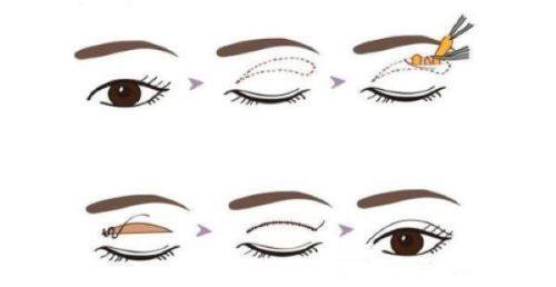 南昌星璨医疗美容门诊部口碑评价