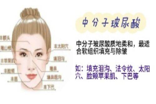 四、隆鼻材料选择的核心参考维度