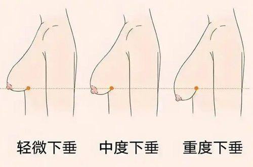 四、复杂增生疤痕的专精综合治疗方案