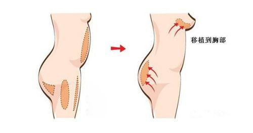 六、遵循医嘱的重要性