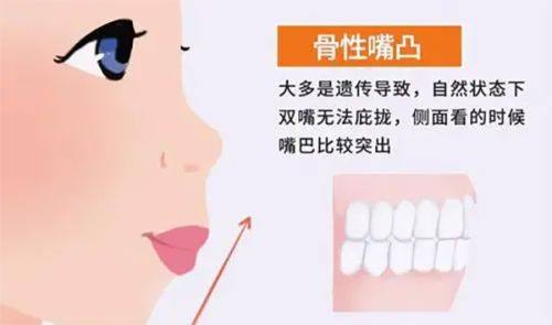 三、侧睡的潜在影响与风险