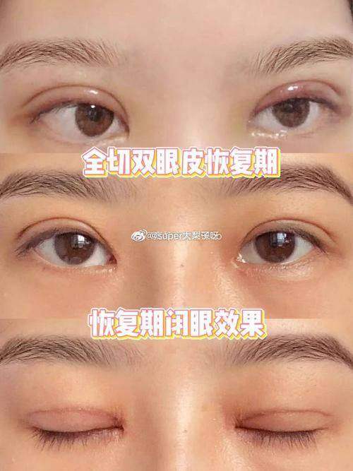 上海伊美尔瑞阳整形美容医院擅长项目: