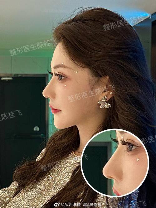 肇庆民和医院医疗美容科怎么样?