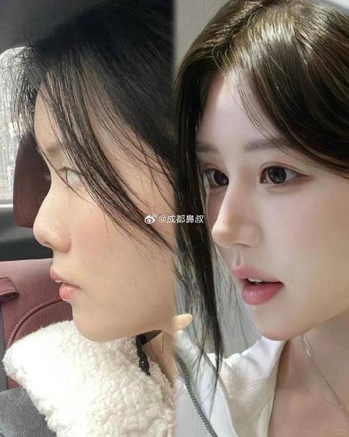 肇庆民和医院医疗美容科价格表: