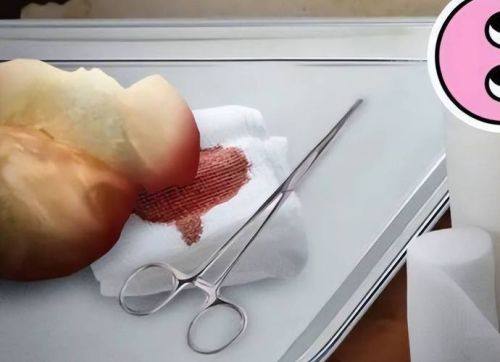 邯郸纺织有限公司职工医院美容整形科擅长项目：