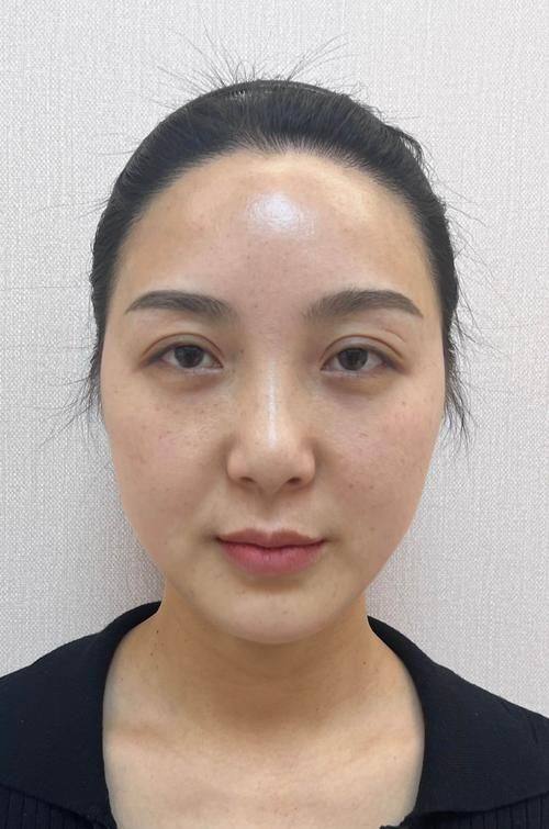 义乌秀昊医疗美容门诊部怎么样？