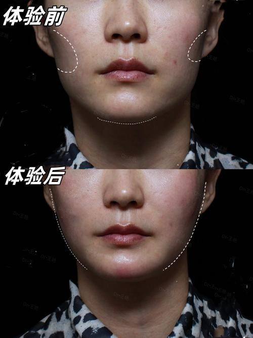 武汉东南医院整形美容科怎么样？