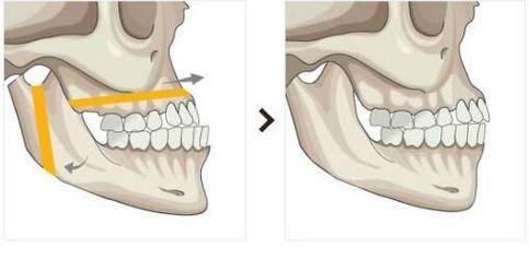 武汉东南医院整形美容科擅长项目：