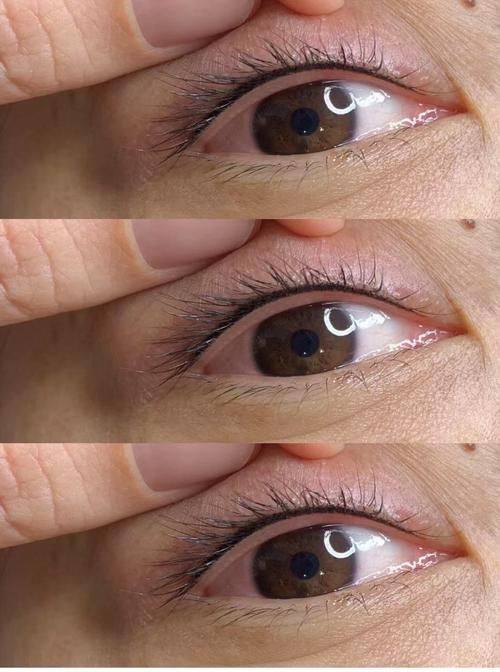 福州雅瑟时光整形美容口碑评价：