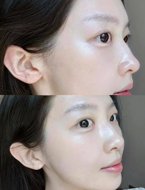 青岛青禾整形医疗美容诊所口碑评价：