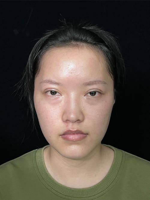 青岛青禾整形医疗美容诊所价格表：