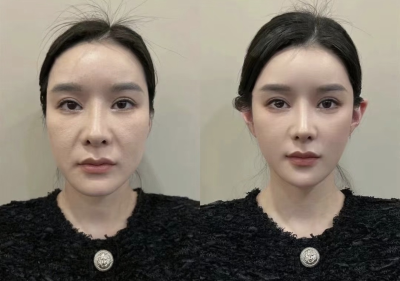 南昌星璨医疗美容门诊部怎么样