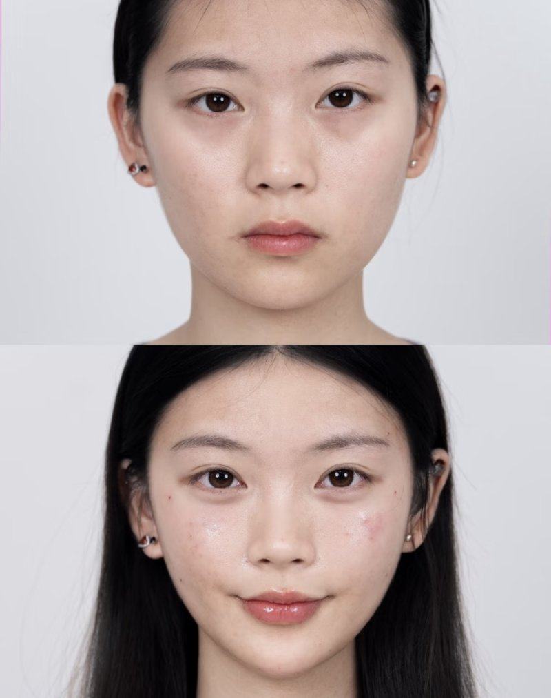 五、怎么才能快速消除眼袋(持久改善方案)