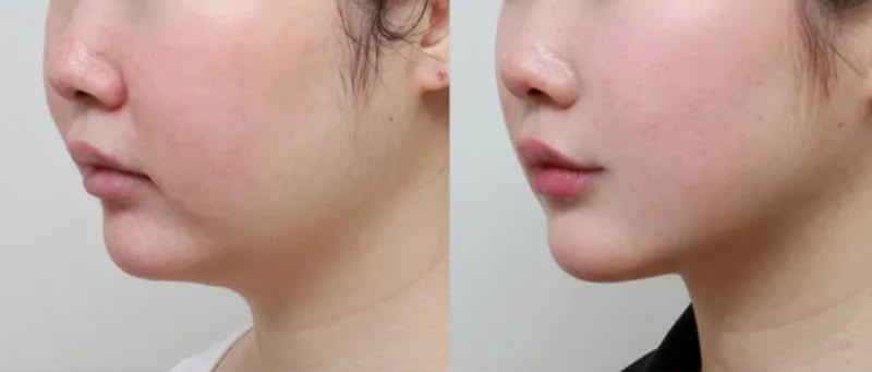 肇庆民和医院医疗美容科预约挂号方式: