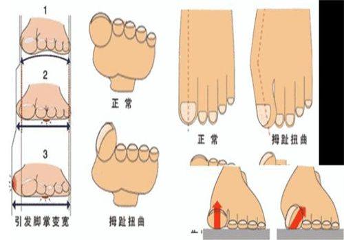 万鹏医生技术优势