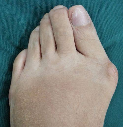 何毅明医生技术优势