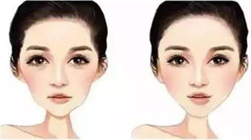 四、其他类型烫伤疤痕的针对性修复方案