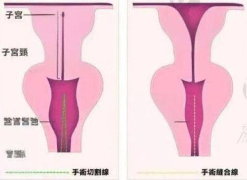 五、如何根据自身情况选择合适的修复方案