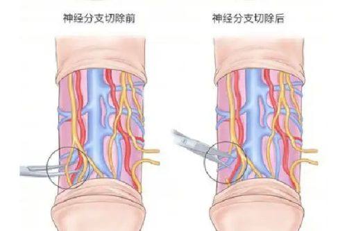 三、非手术临时改善技巧（过渡选择）