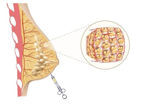 二、真实治疗实例:不同方案的成效参考