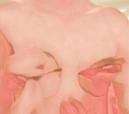 滁州东方伊尔美整形医院怎么样