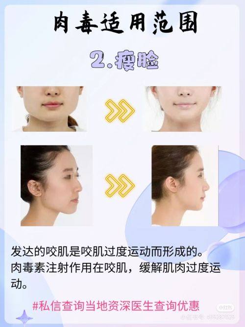 三、疤痕增生消除实用方法，日常护理+医学干预双管齐下